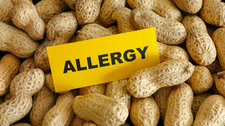 Peanut allergy.