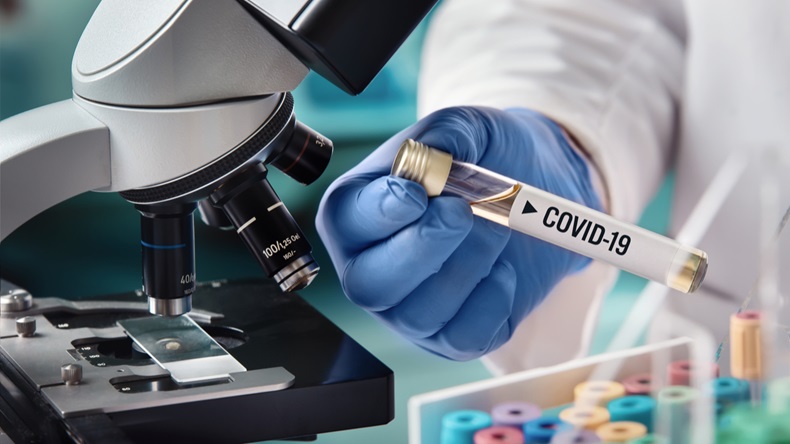 microbiologist with a tube of biological sample contaminated by Coronavirus with label Covid-19 / doctor in the laboratory with a biological tube for analysis and sampling of Covid-19 infectious disea